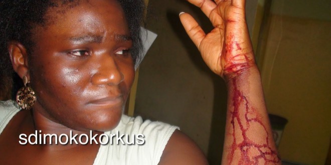 Dino Melaye’s wife  releases picture showing she was beaten