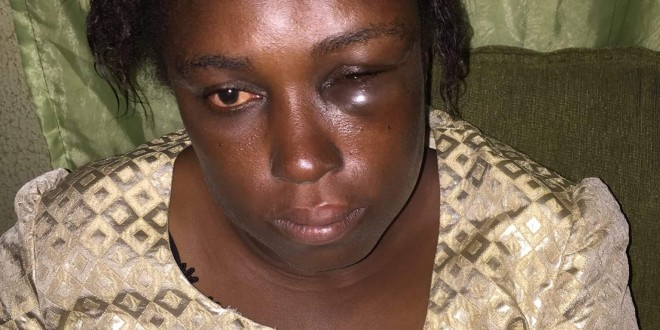 Mfm zonal pastor wife releases pics alleging husband beats her