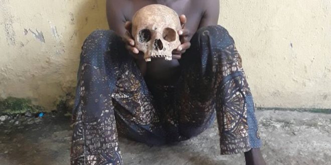 Lagos Police Arrest Man In Possession Of Fresh Human Skull